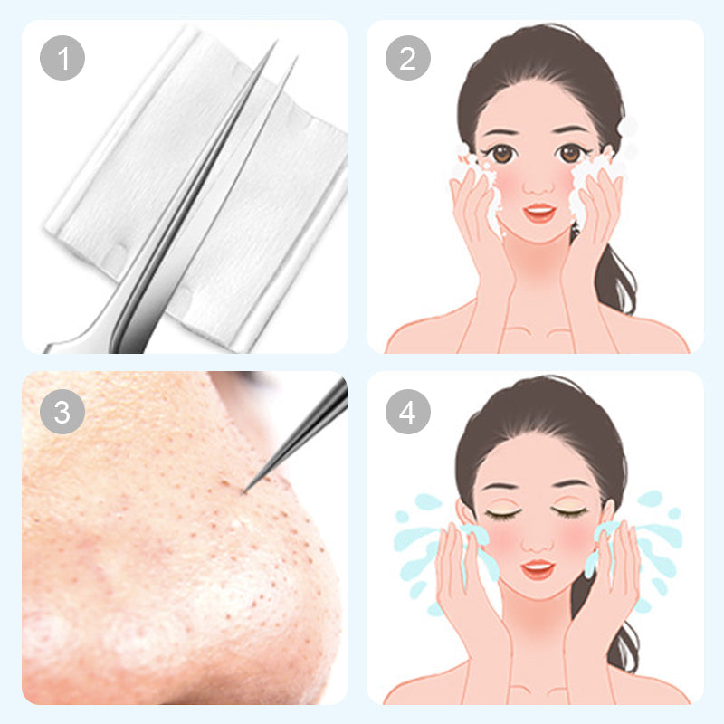Stainless Steel Blackhead Remover Set